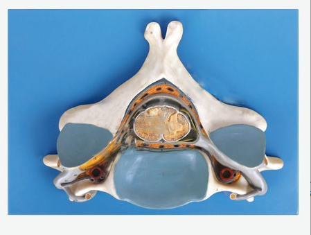 脊髓橫斷模型（第五頸椎附脊髓和脊神經放大模型）